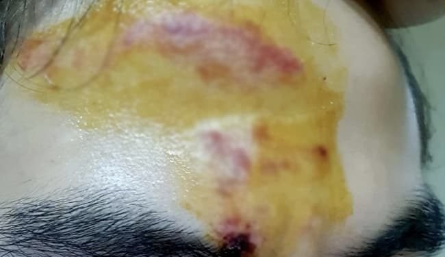 Safeguarding Cadets From Physical Abuse Requires Immediate Action: Human Rights At Sea